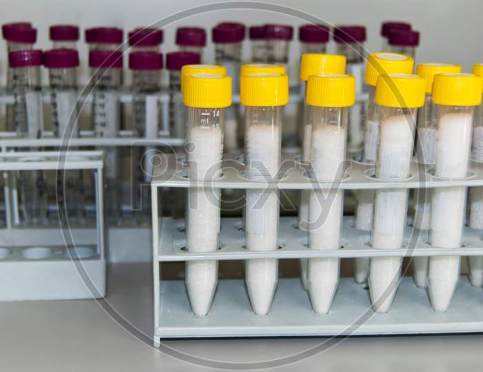 Set of laboratory test tube