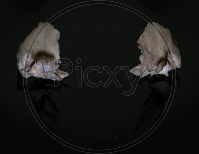 Bilateral Human Temporal Bones Of Skull On A Dark Background .Anterior View