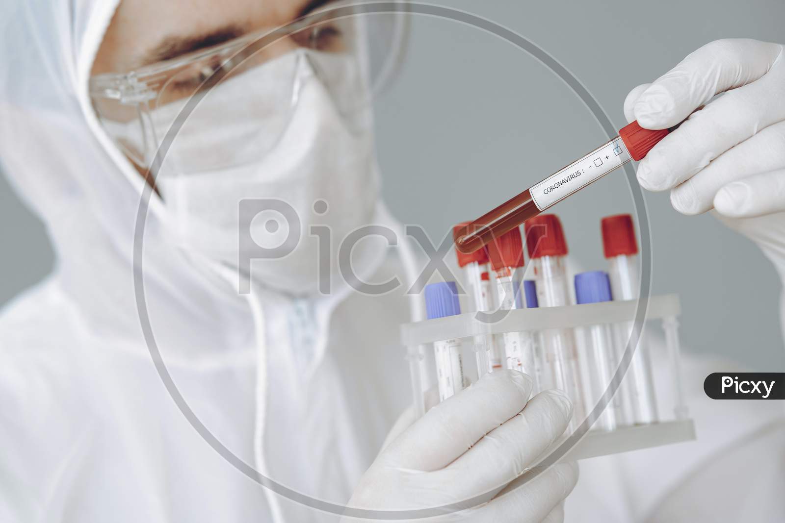 Scientist holding test tube with positive coronavirus