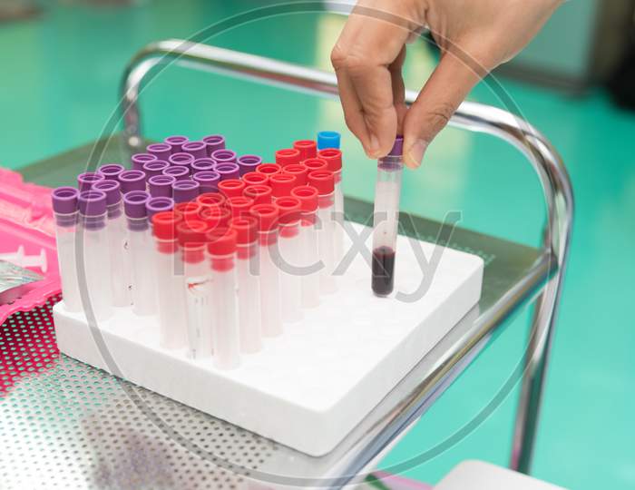 Blood Test Collect In Test Tube At Laboratory Of Hospital. Physical Examination And Healthcare Concept