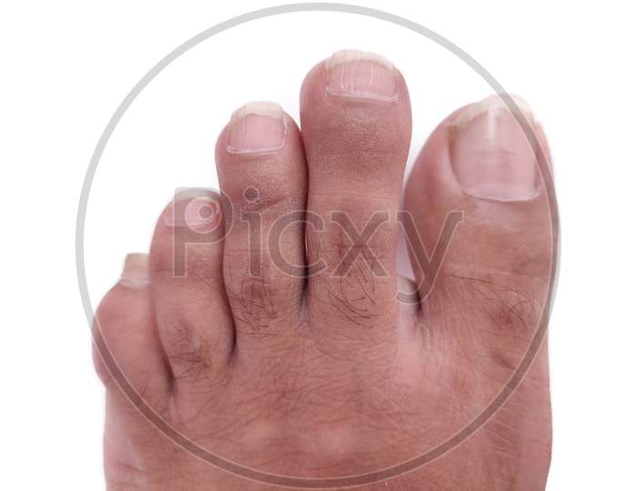 Man's left foot fingers Close-up top view on White background