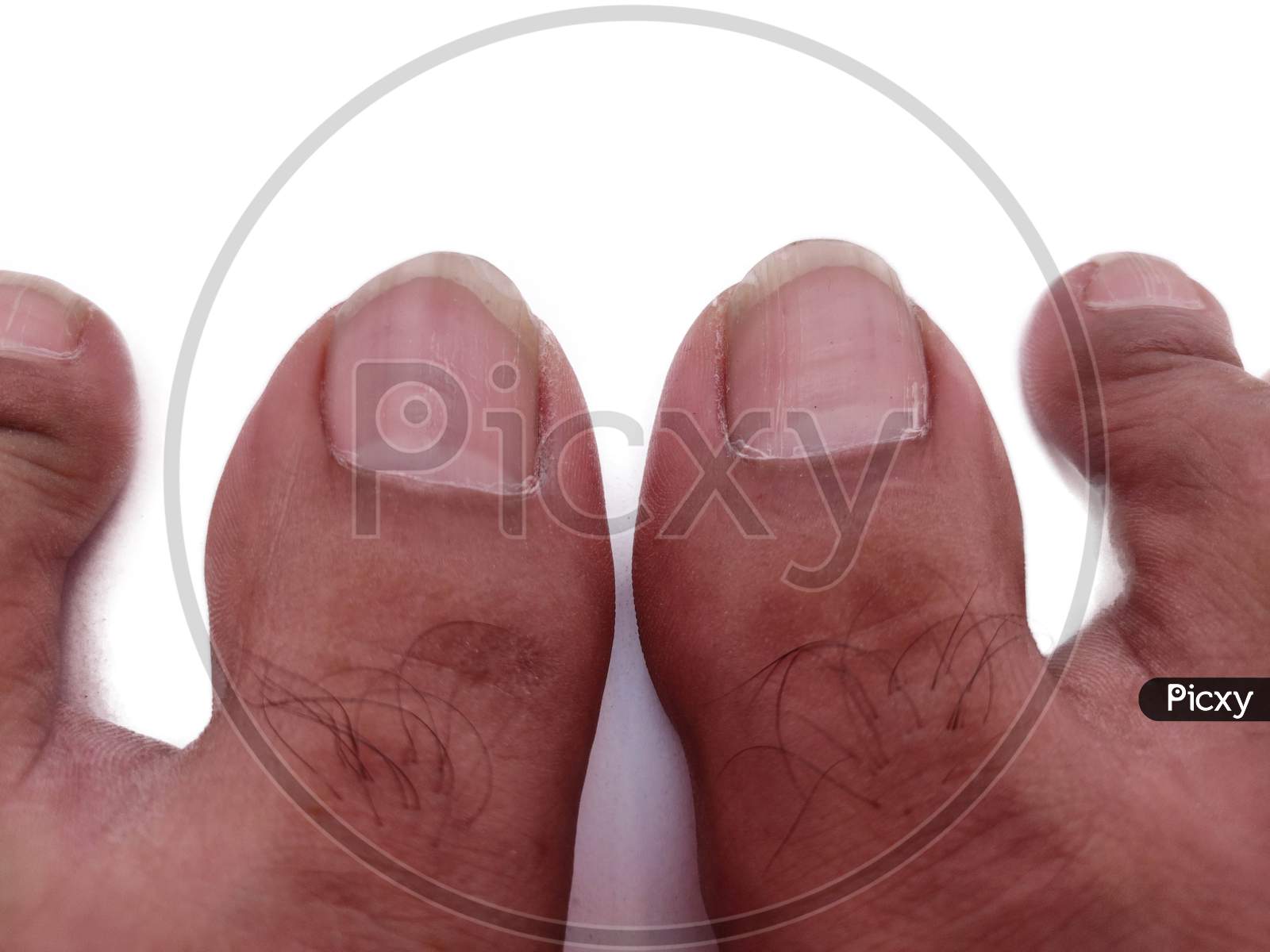 Man feet toes with nails Close-up top view on White background isolated.