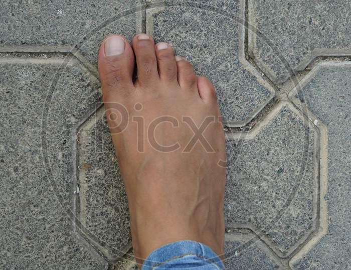 Close Up Of Women'S Foot Isolated On A Concrete Floor Background. Foot Is Ugly, Dark Brown And It Has Hair And Veins Showing. No Manicure. Unmanicured Nails.