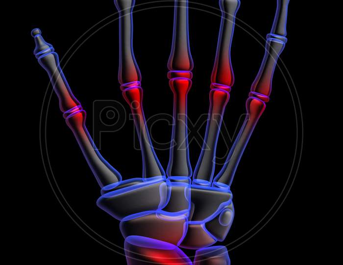 3D Human Hand Pain
