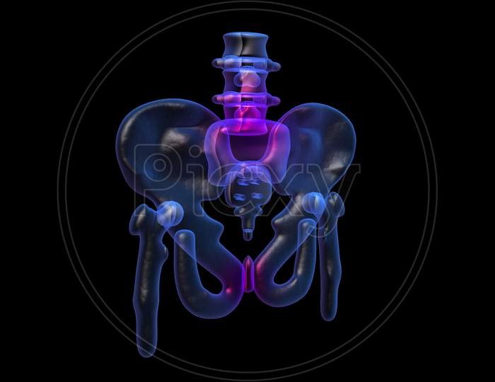 3D Painful Hip In Black Background