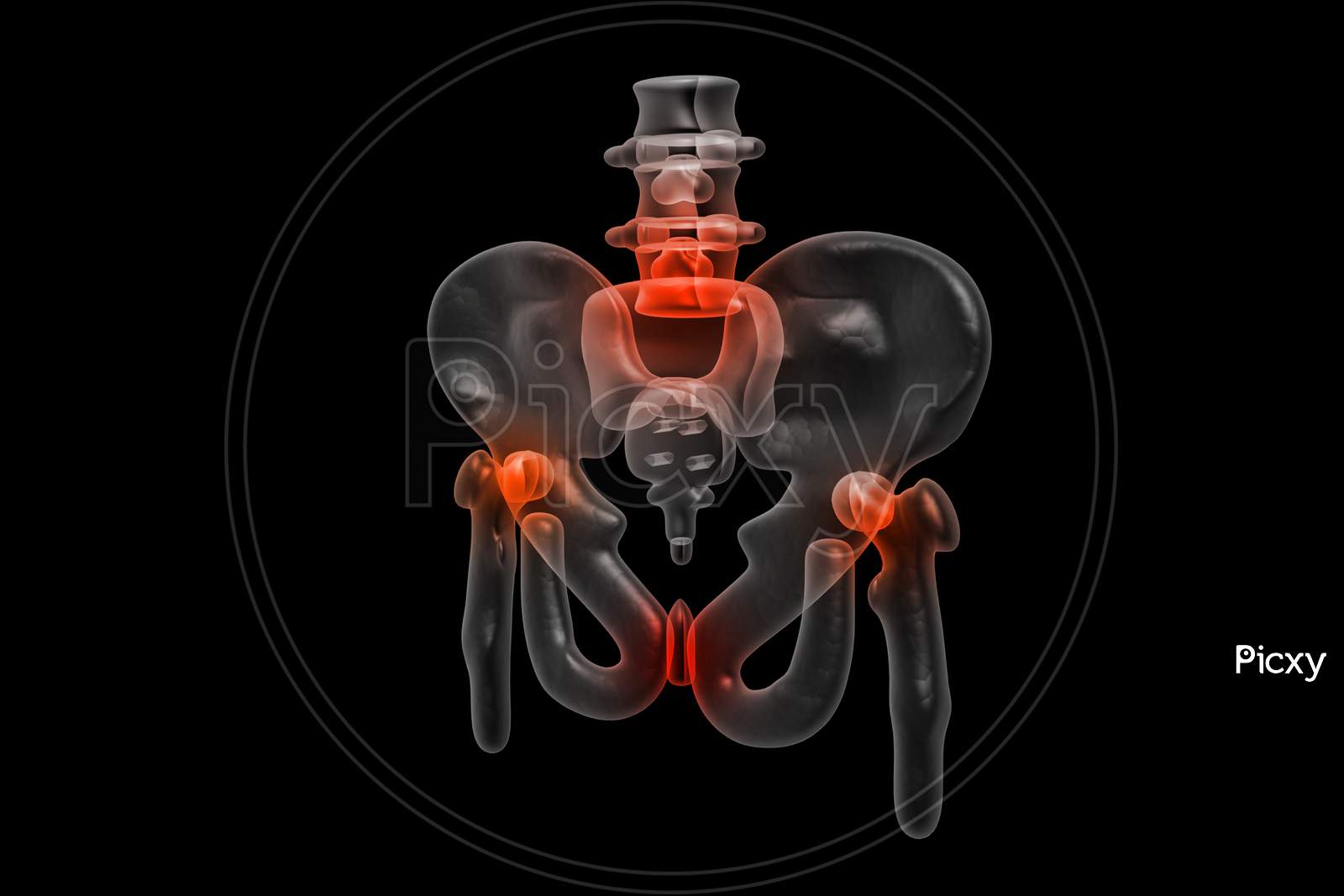 3D Painful Hip In Black Background