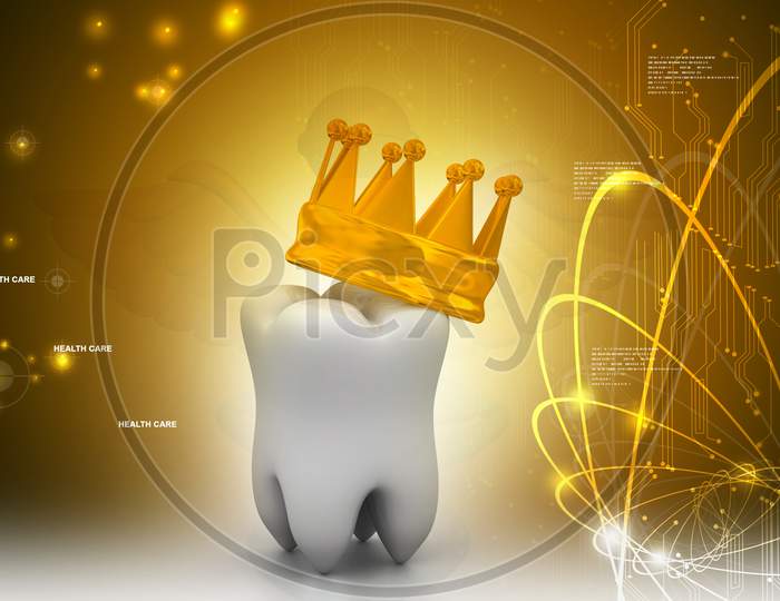 Tooth In Golden Crown