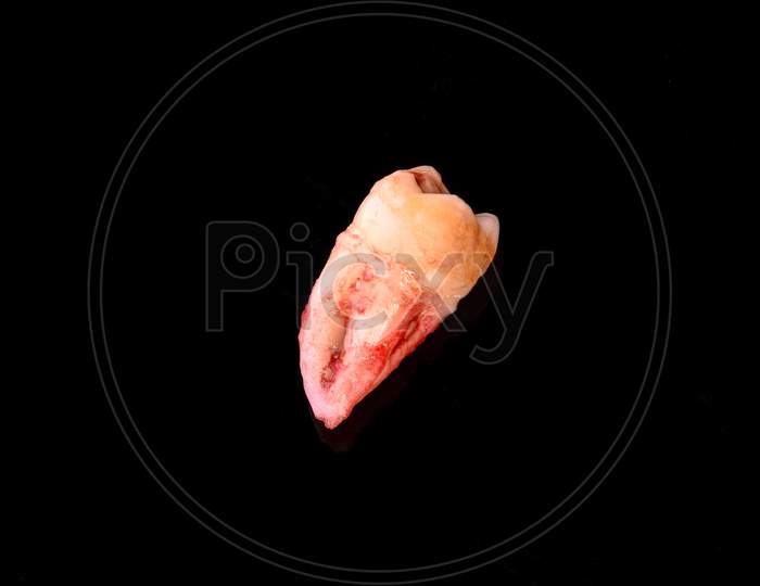 A Closeup Left Upper Third Molar After Extraction (Adult Tooth Number 28)
