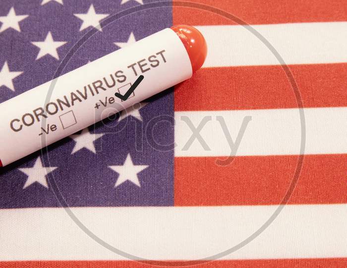 Coronavirus Positive Test On Blood Collection Tubes On Us Flag - Concept Of Virus Found In Usa.