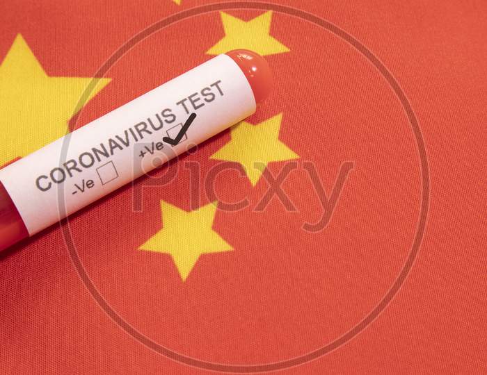 Coronavirus Positive Test On Blood Collection Tubes On Chinese Flag - Concept Of Virus Found In China.
