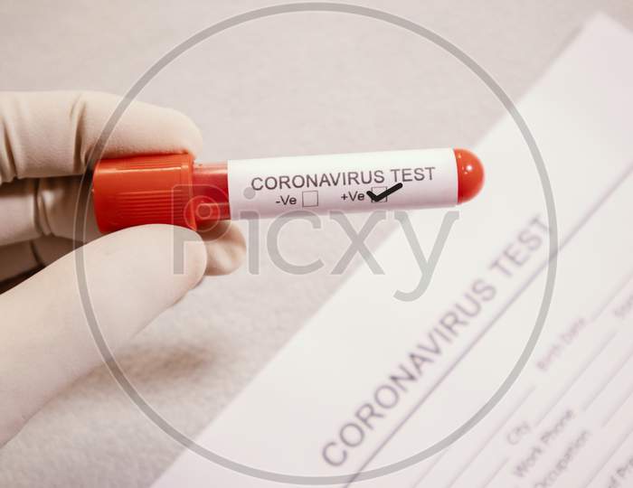 Coronavirus Doctor Holding A Test Tube With Blood Sample For Coronavirus Or 2019-Ncov