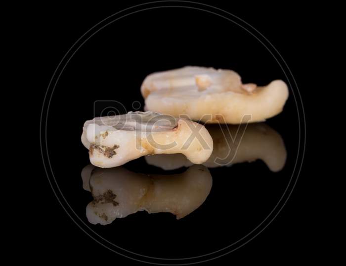 A Closeup Of A Sectioning Right Lower Third Molar With Curved Root. (Adult Tooth Number 48)