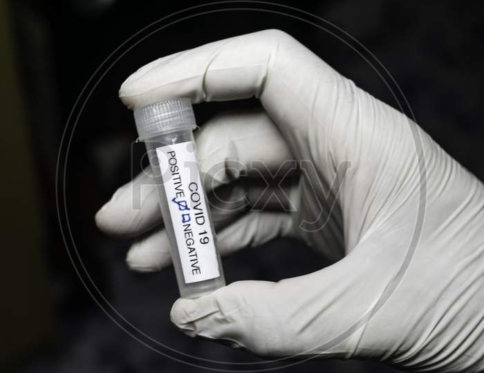 Testing For Presence Of Coronavirus. Tube Containing A Swab Sample That Has Tested Positive For Covid-19.