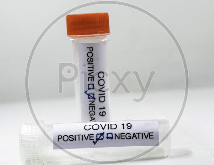 Positive Covid-19 Test And Laboratory Sample Of Blood Testing For Diagnosis New Corona Virus Infection(Novel Corona Virus Disease 2019)From Wuhan With Hospital Background. Pandemic Infectious Concept