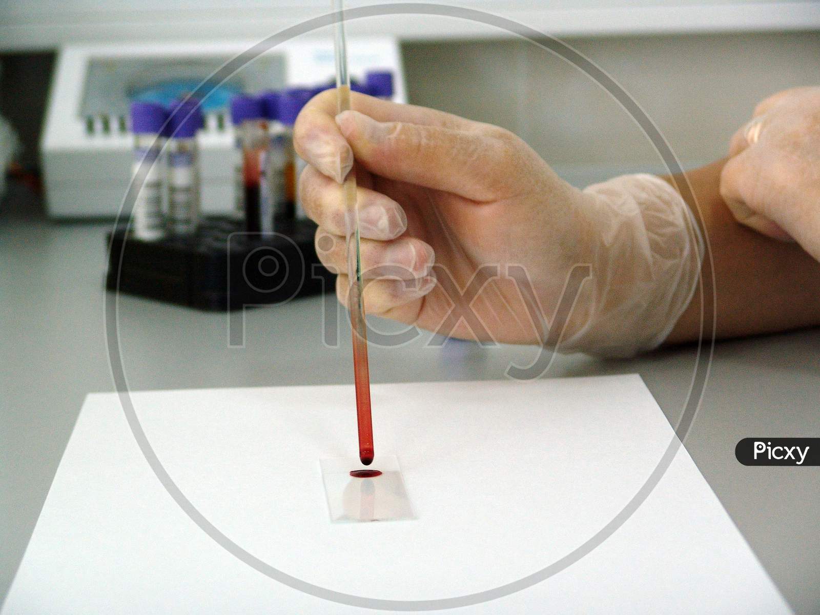 Putting a drop of blood on glass slide