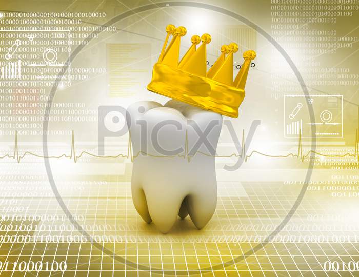 3D White Tooth With Crown On Top