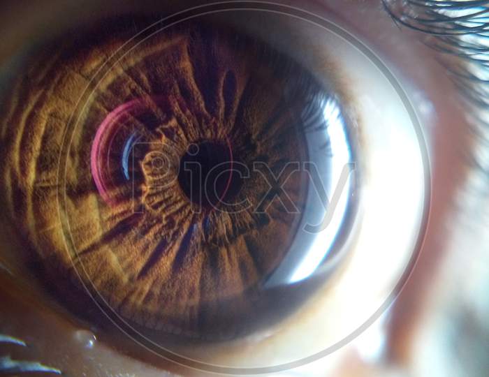 Eye macro