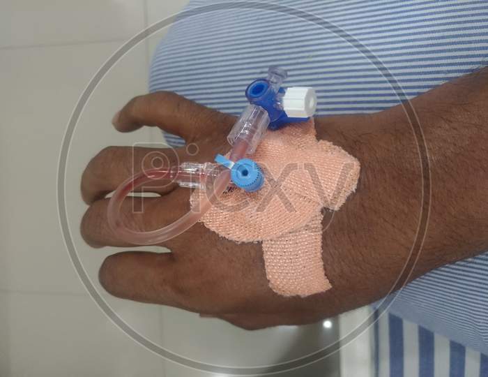 IV drip needle in patient's hand.