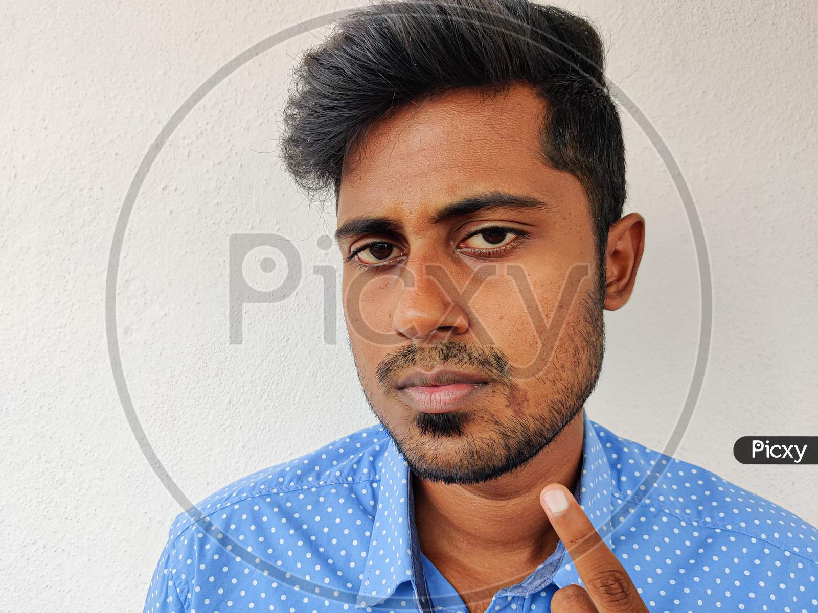 Portrait Of South Indian Man With A Scar In His Face. Real Face, Real Body. Skin Conditions.