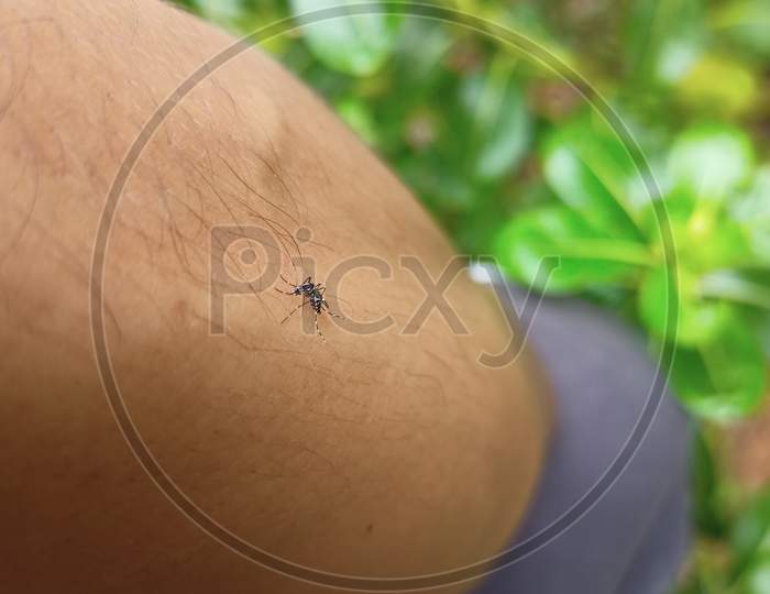 Macro Of Mosquito Sucking Blood On Surface Of Human Skin