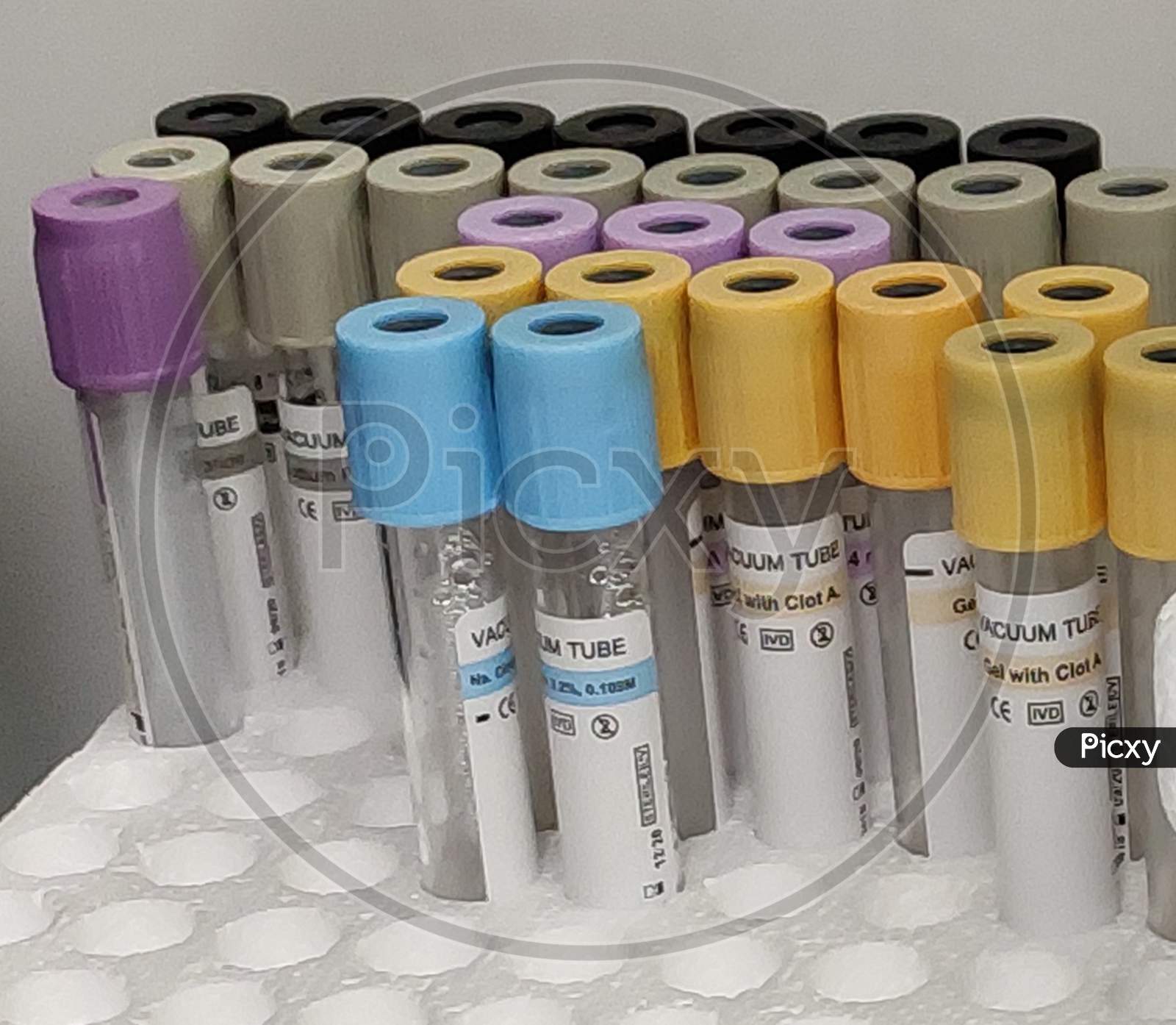 Blood test kit arranged in tube holders