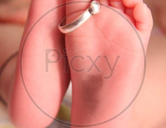 Wedding Rings On The Little Legs Of A Newborn Baby.