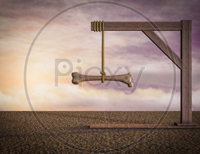Human Thigh Bone On Gallows At Sunset Magenta Day Demonstrating Osteoporosis Struggle Concept. 3D Illustration
