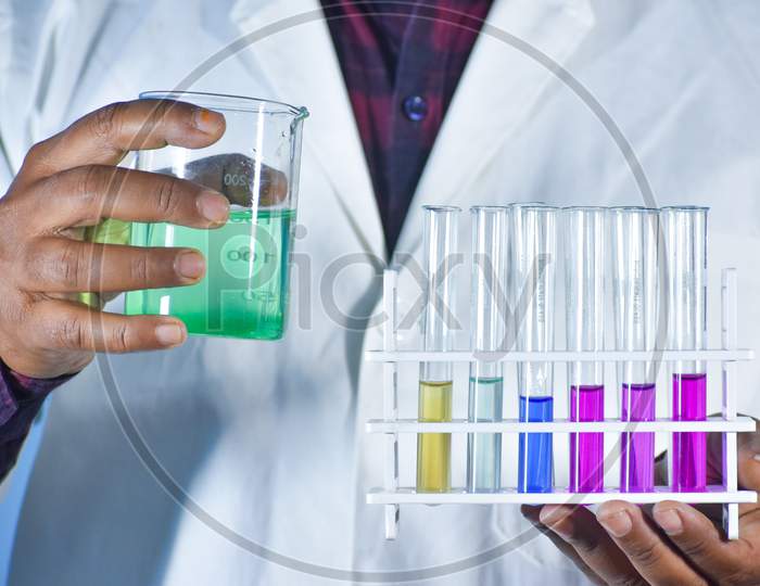 Scientist Carry Color Liquid In Hand. Color Solution In Test Tube Stand