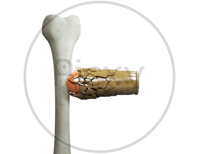 Human Thigh Bone Hitting From A Bullet And Destroy It In White Background. Strong Bones And Healthy Human Bone Or Osteoporosis World Day Or Retirement Age Or Strong Bones Concept. 3D Illustration