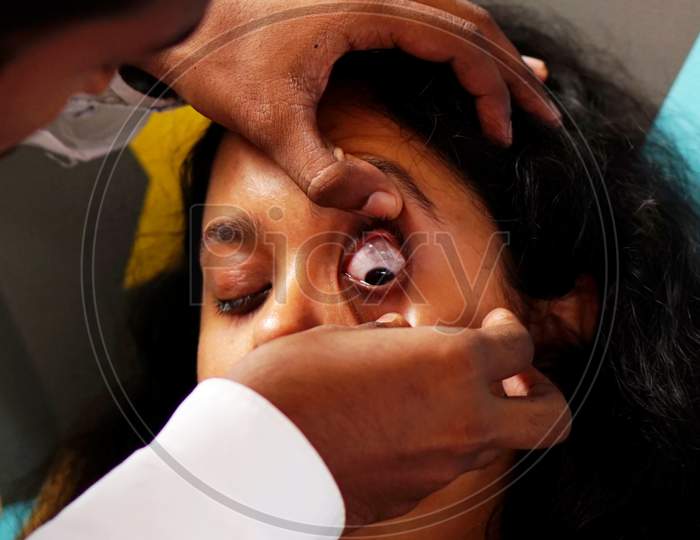 Close-Up View Of Indian Male Doctor Checking Woman Patient Eye To Insert Contact Lens In A Clinic