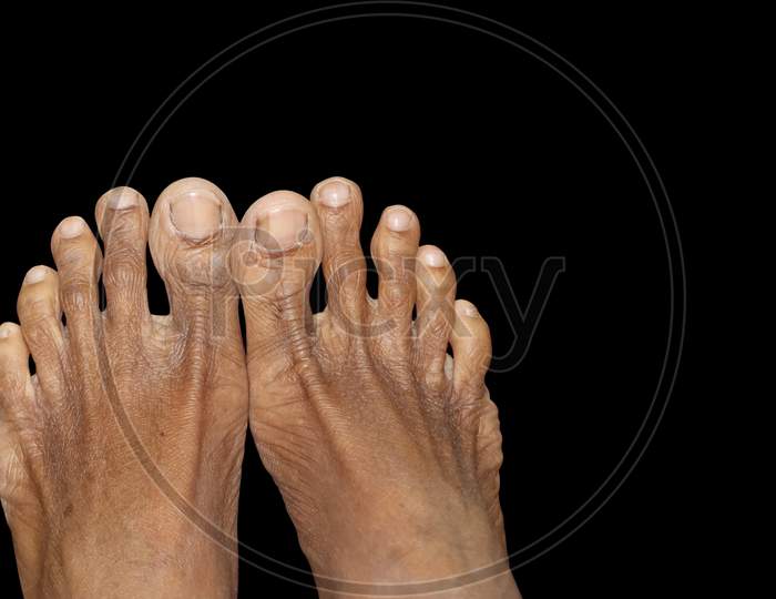 Human Male Feet In Isolated Black Background