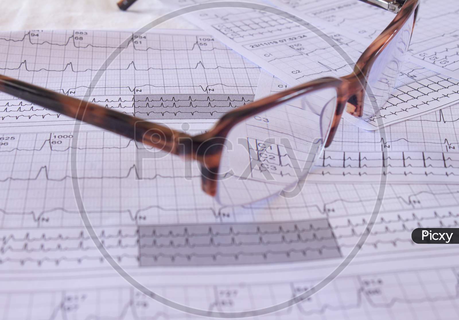 Eyeglasses On An Ekg In The Doctor'S Office. Representation Of Heartbeats On Graph Paper.
