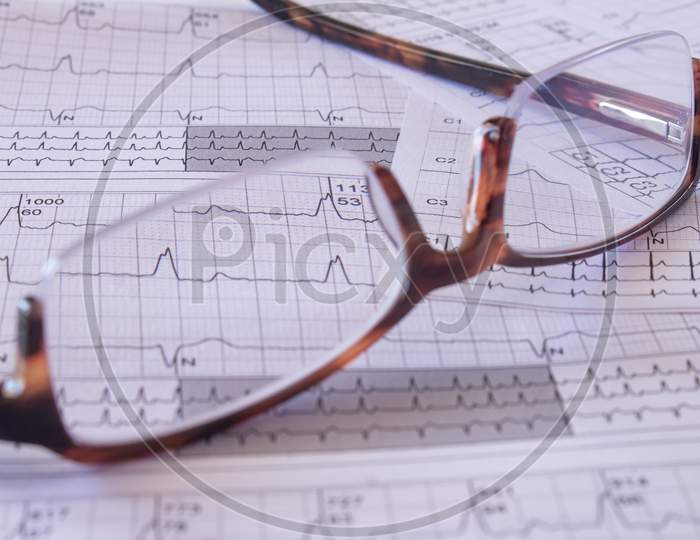 Eyeglasses On An Ekg In The Doctor'S Office. Study Of The Electricity Of The Heart.