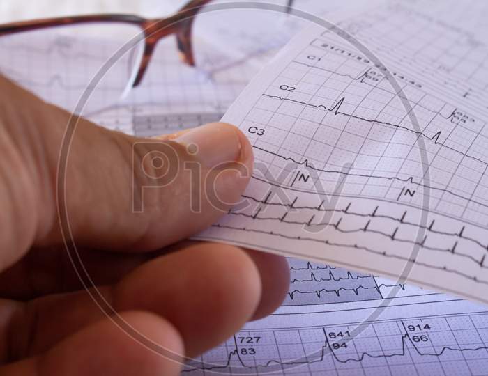 Hands Of A Man Holding An Electrocardiogram In The Doctor'S Office. Representation Of Heartbeats On Graph Paper.