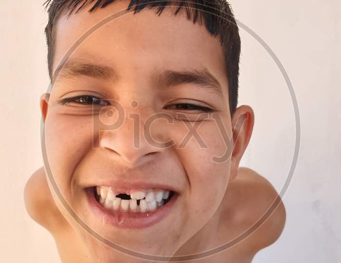 Closeup shot of a shirtless little boy with funny big smile pose, A kid showing his broken teeth with crazy smile, Studio shot of a small boy with wearing white towel and looking at camera.