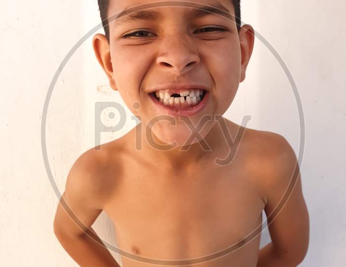 Studio shot of a shirtless little boy with funny big smile pose, A Indian kid showing his broken teeth with crazy smile, A small boy with wearing white towel and looking at camera.