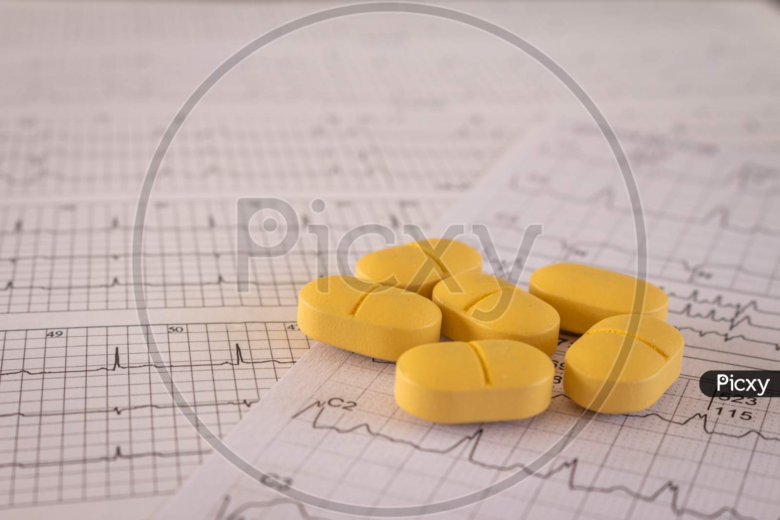 Huge Orange-Yellow Pills On Paper With Ekgs And Cardiac Arrhythmias. Medications For The Heart.