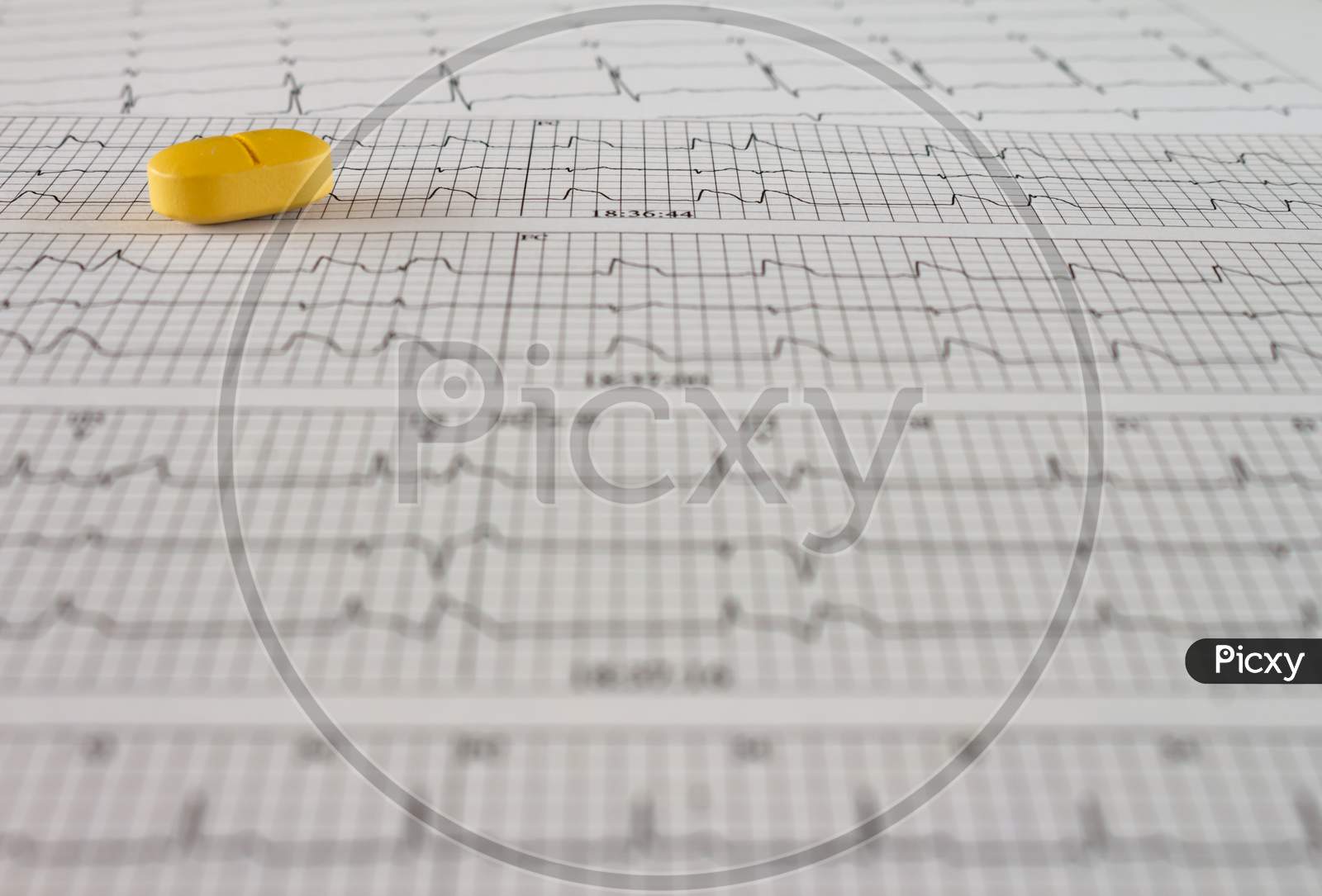 Colored Pills On An Electrocardiogram Paper. Medications For Cardiac Patients. Heartbeats Recorded On Paper. Selective Focus.