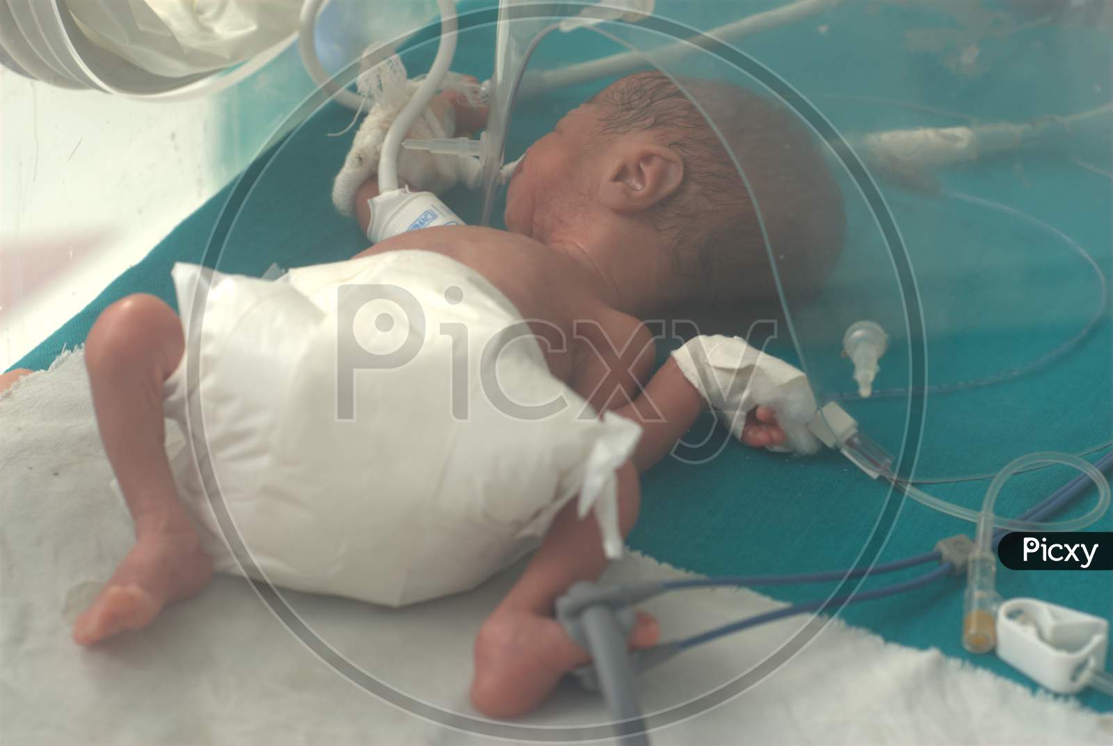 Image Of Premature Baby In A Incubator Under The Supervision Of Doctors Tw Picxy