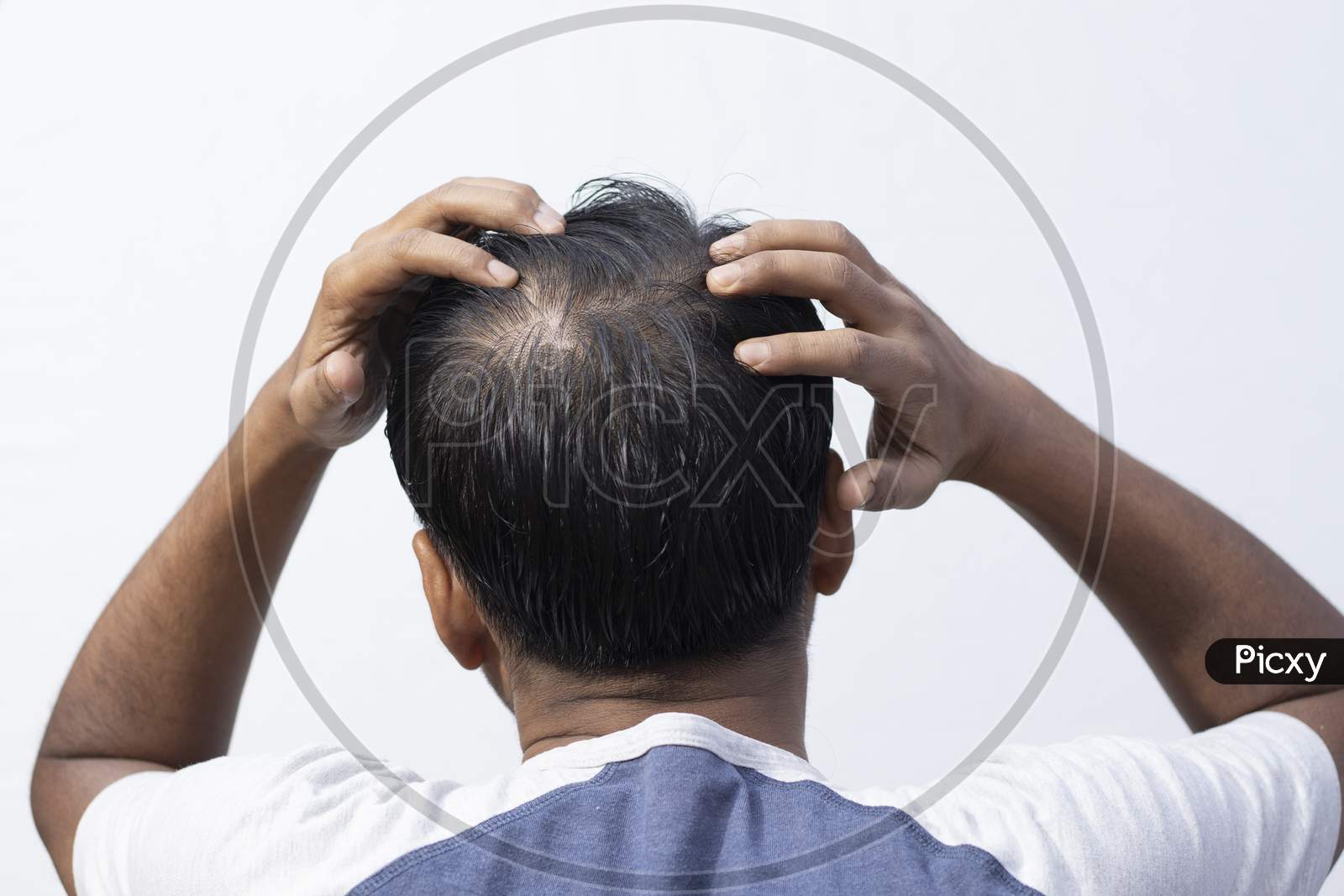 Hair Fall Problem For Men