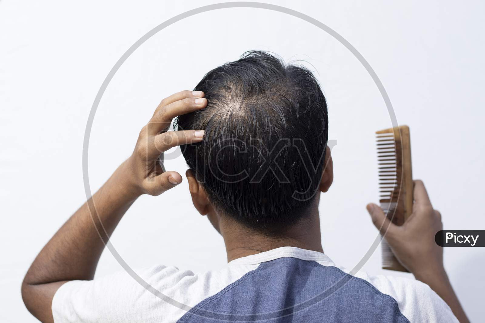 Hair loss one of the daily annoying problems that dont affect your  health but capable of lowering your selfconfidence and degrading your  personality There are various causes of hair loss so it