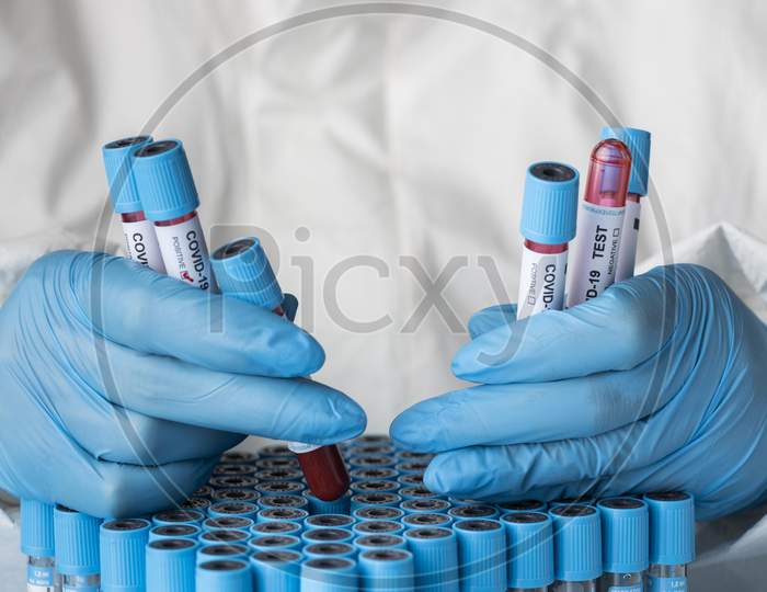 Hand with protective gloves holding blood samples for covid test