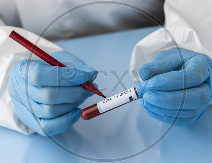 Hand with protective gloves holding a blood sample for covid