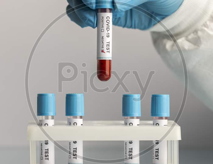 Hand with protective gloves holding a blood samples for covid test