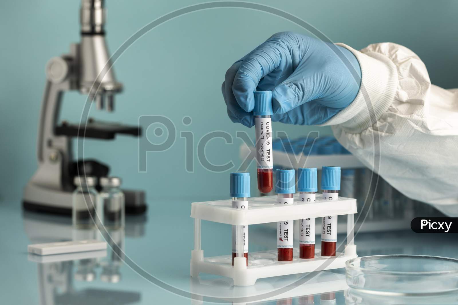 Hand with protective gloves holding a blood samples for covid test