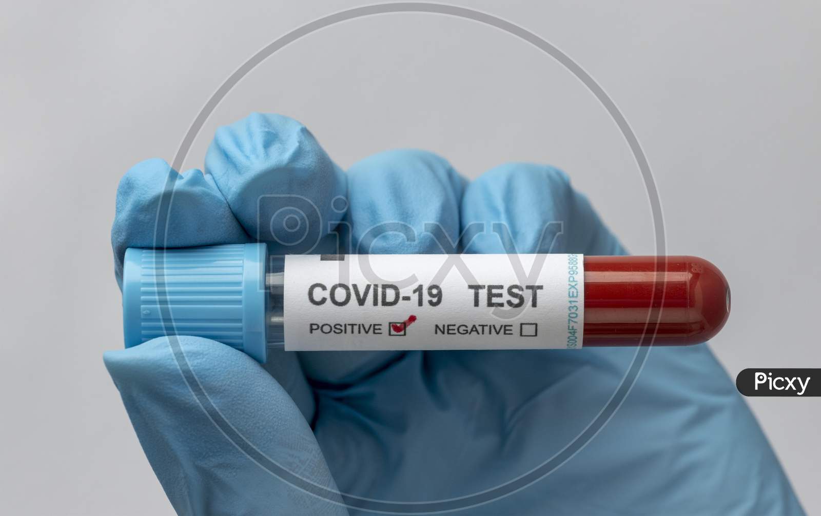 Hand with protective gloves holding a blood sample for covid test