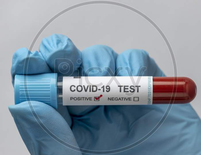 Hand with protective gloves holding a blood sample for covid test