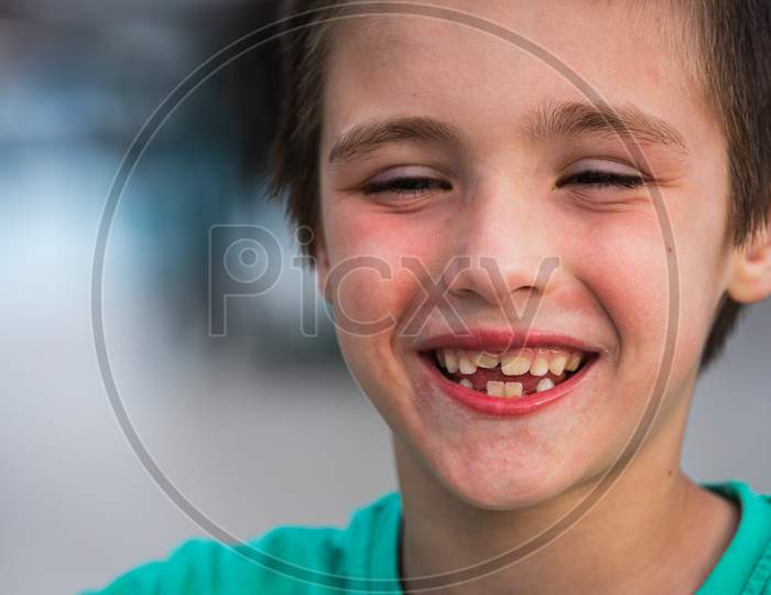 Portrait Of A Cheerful Smiling Boy On Soft Focus. Smile With Changing Milk Teeth To Korean Ones