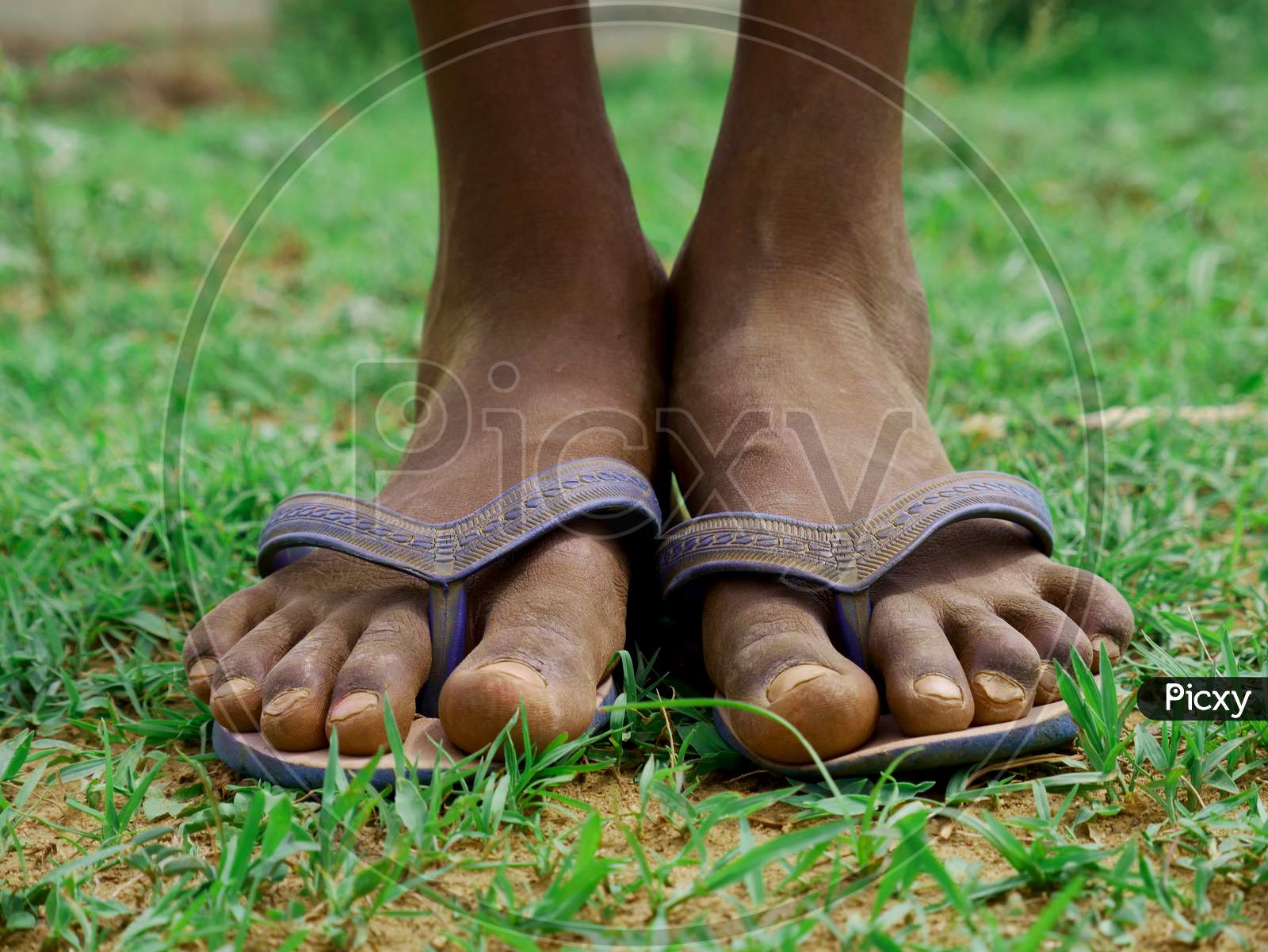 Image of Poor Boy Feet With Sleeper Closeup-NO626720-Picxy