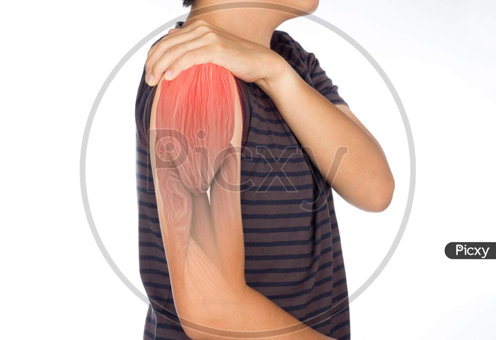 upper arm muscles pain